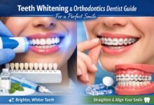 Teeth whitening